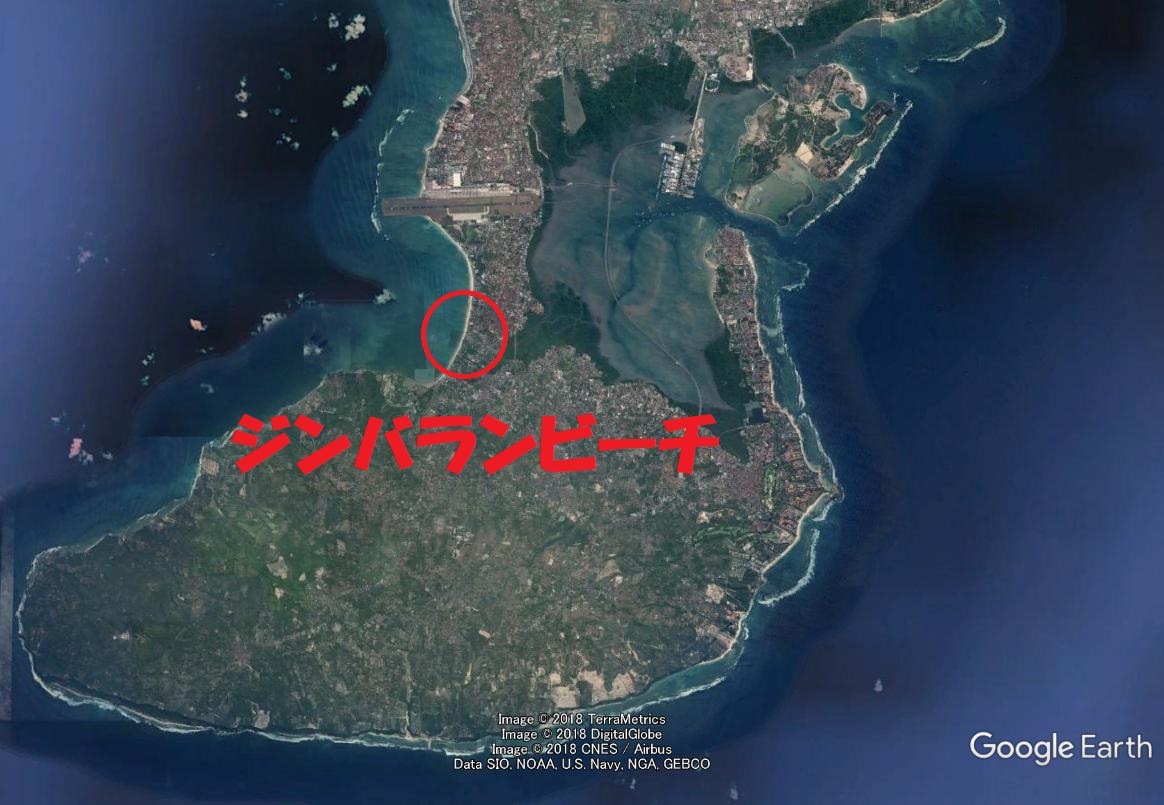  CTスキャナーを内側から見たことがありますか?